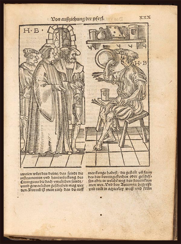 Hieronymus Brunschwig