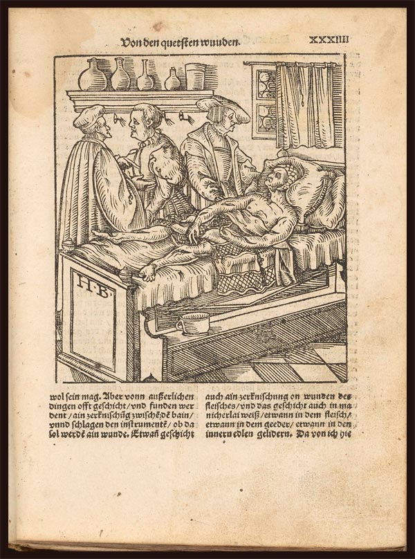 Hieronymus Brunschwig